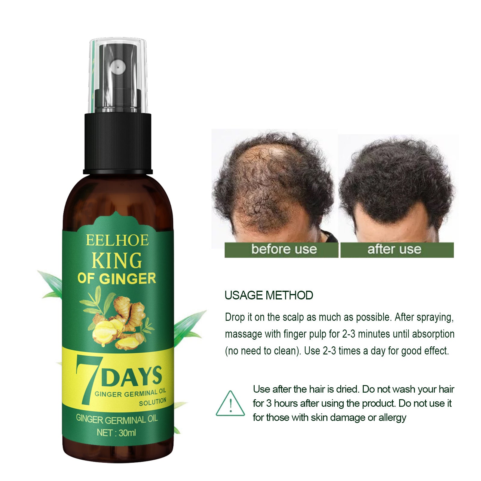 Ginger Hair Spray  30ml Boxes Strengthening Hair, Massaging Scalp, Hair Quality Repair, Hair Care Liquid